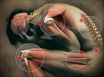 La Artritis de la Mano y de la Muñeca